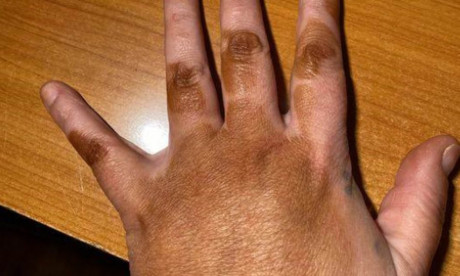 Wife Wakes To A Disastrous Fake Tan Fail Before A Romantic Weekend With Her Husband Mail