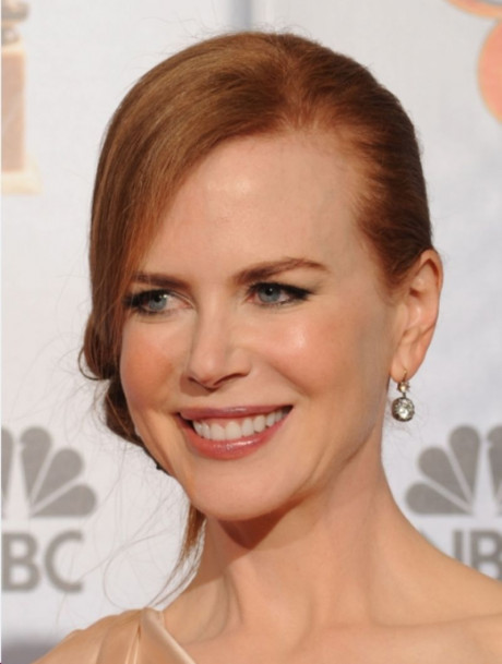 Kidman