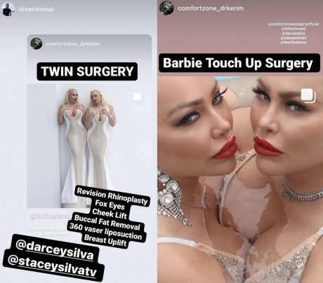 90 Day Fiance Twins Are Unrecognizable After Shocking Plastic Celebritytalker